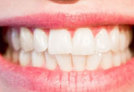 Orthodontics