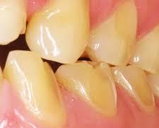 teeth