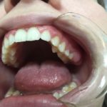 dental emergencies
